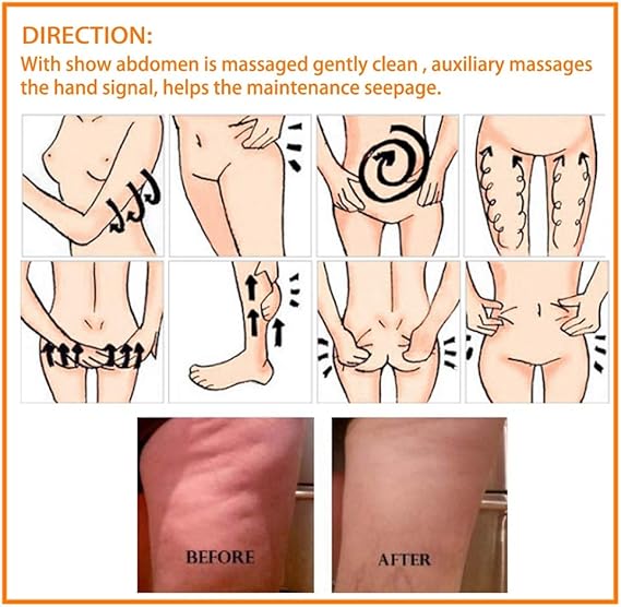 **Melao Crema Caliente** – Adelgazamiento, Reducción de Celulitis y Reafirmante para el Cuerpo Crema ideal para la quema de grasa abdominal y tonificación del cuerpo, con extracto de jengibre para mejores resultados.